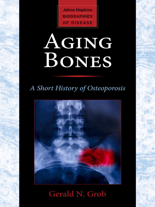 Title details for Aging Bones by Gerald N. Grob - Available